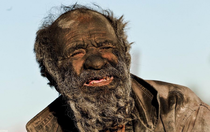 Человек не мылся 60 лет, как он выглядит